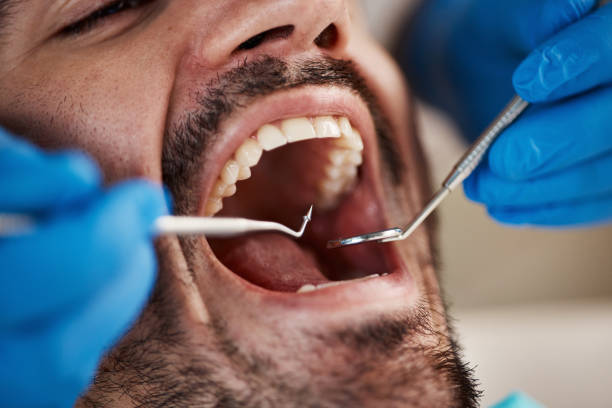 Best Tooth Extraction  in Beecher, IL